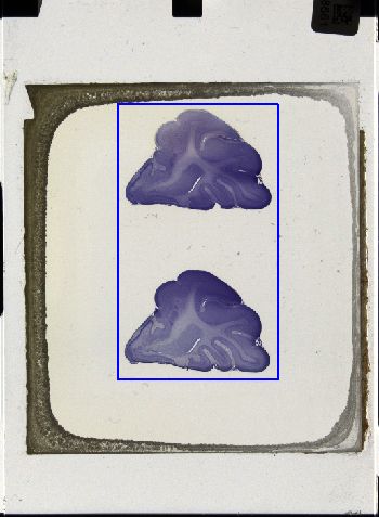 Media type: image; Special Collections 3043   shows specimen_part histological serial section;